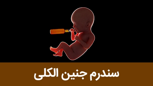 سندرم جنین الکلی