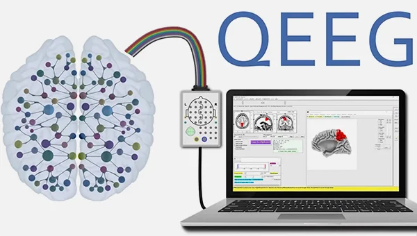 نقشه مغزی یا QEEG چیست؟