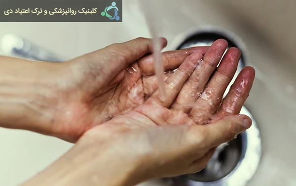  اختلال وسواس فکری عملی